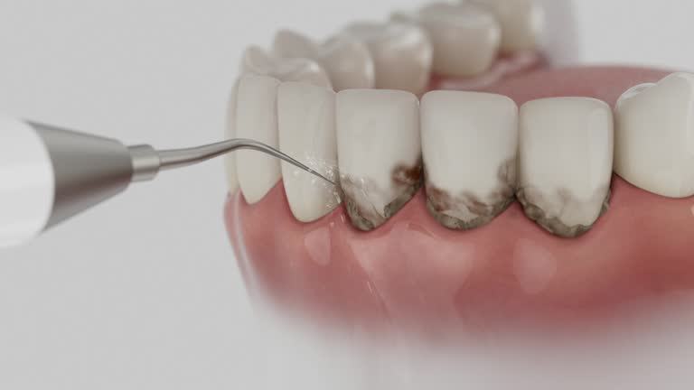 Reliable Dental Implants contractor in Orchards, WA by Smile Center Dentistry